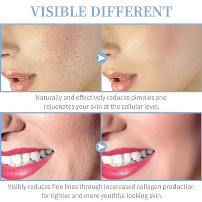 Charm Beauty™ Device for skin treatment and rejuvenation